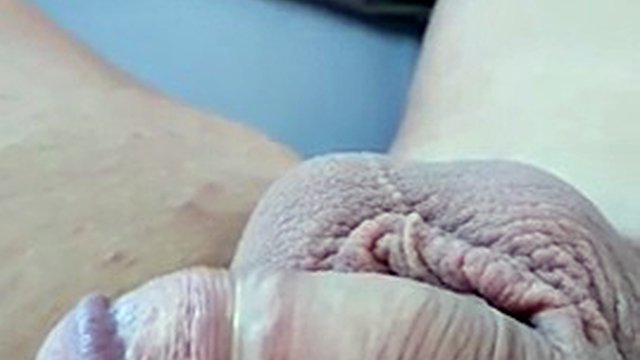 My micro penis